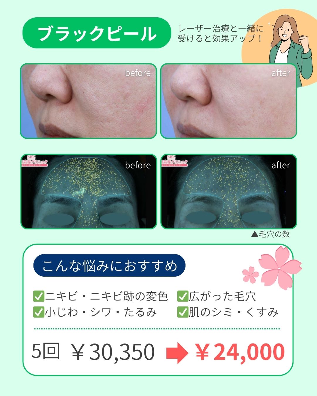 肌のトーンアップ！肌チカラアップ💪