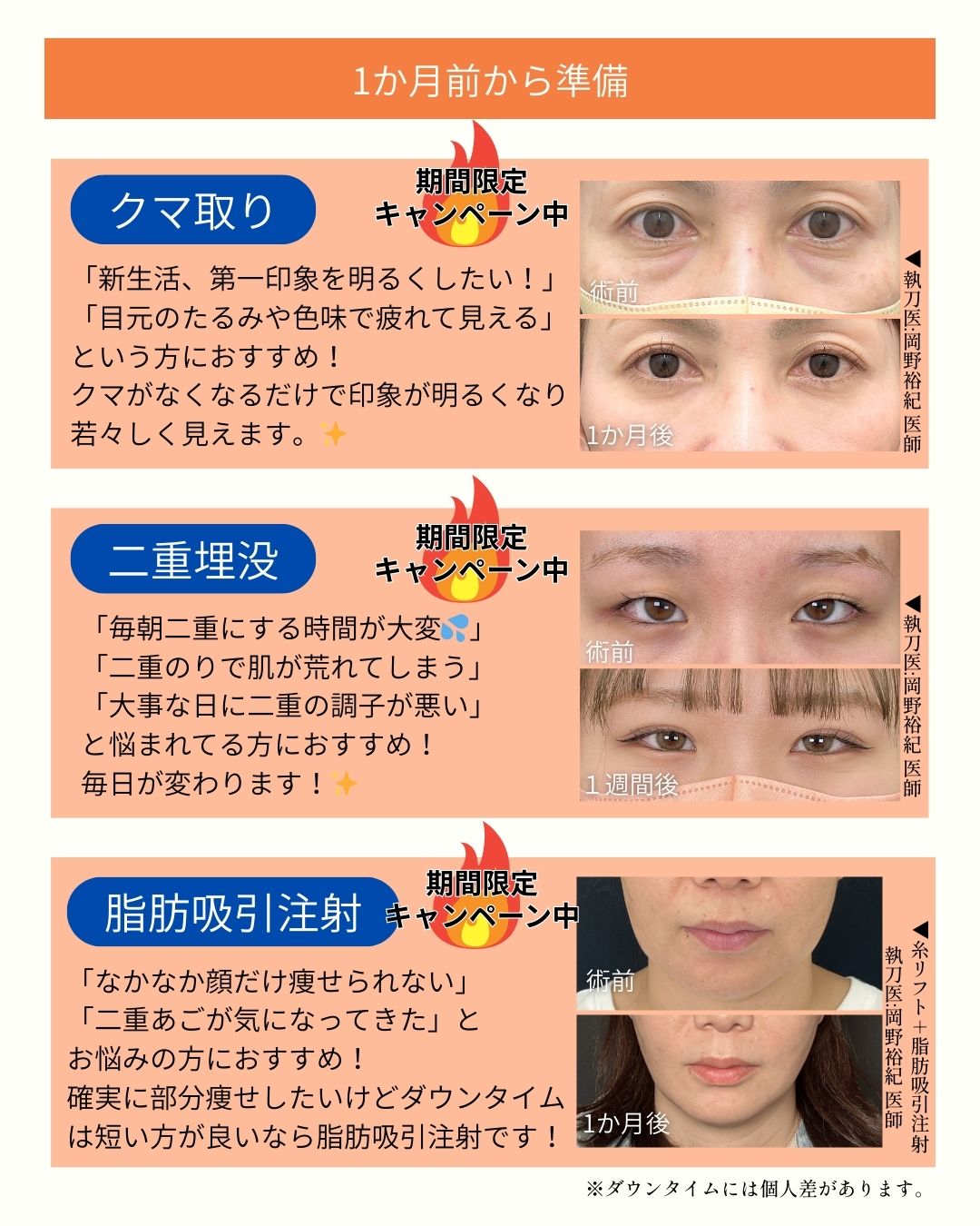 大事なイベントに向けて確実に垢抜け隊！