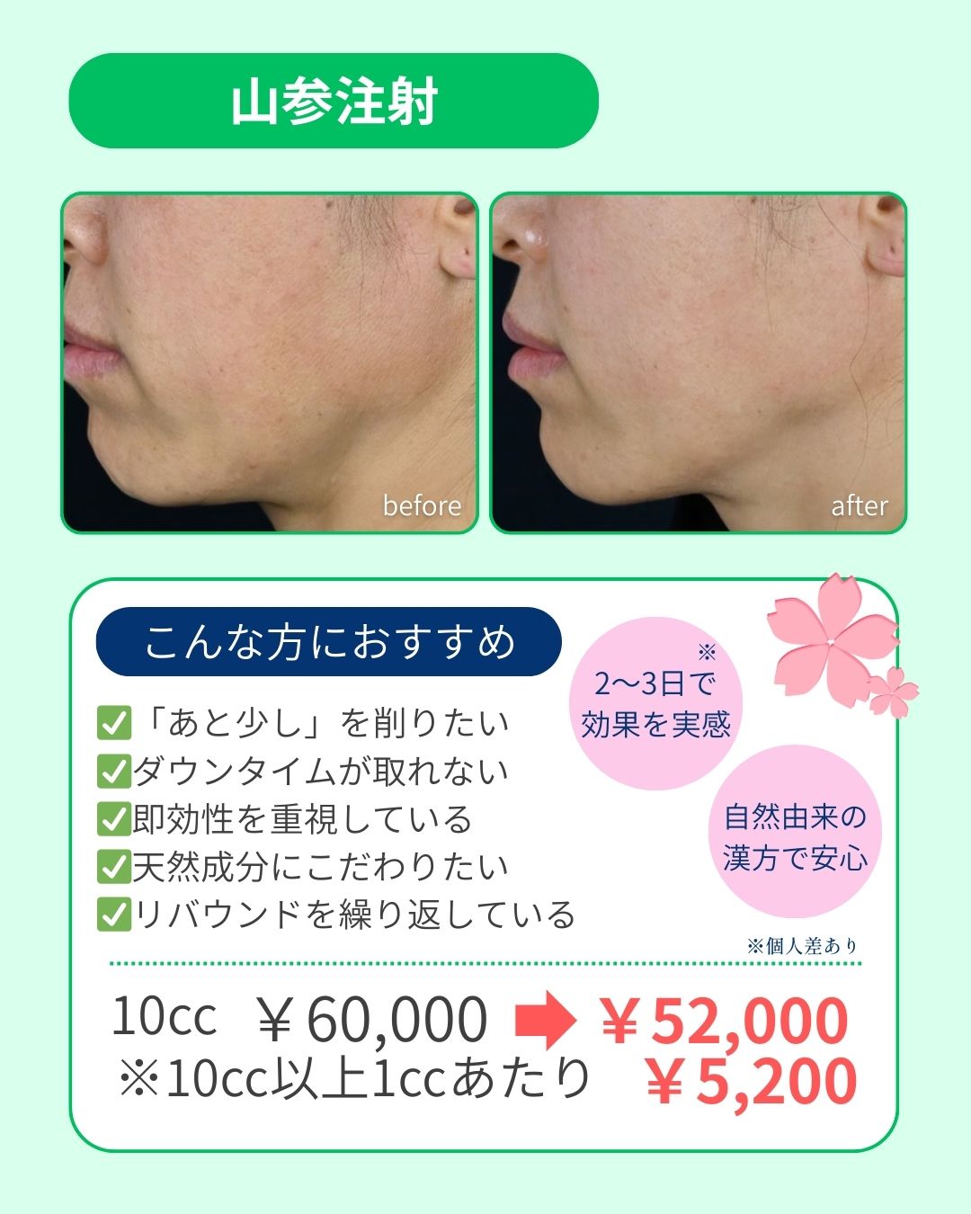 漢方由来の小顔注射💉