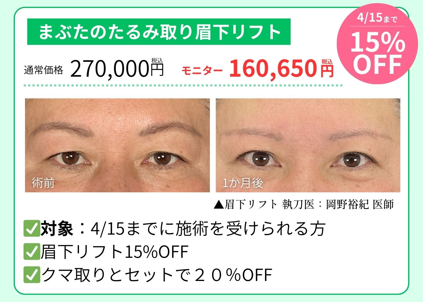 重くなったまぶた・目の開き改善