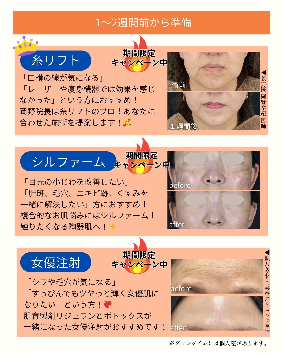 無加工なのに美肌フィルター付いてる？！