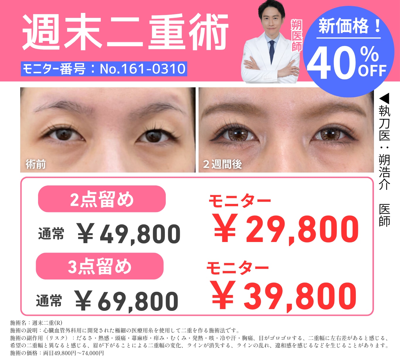 二重術がさらに手軽に！✨