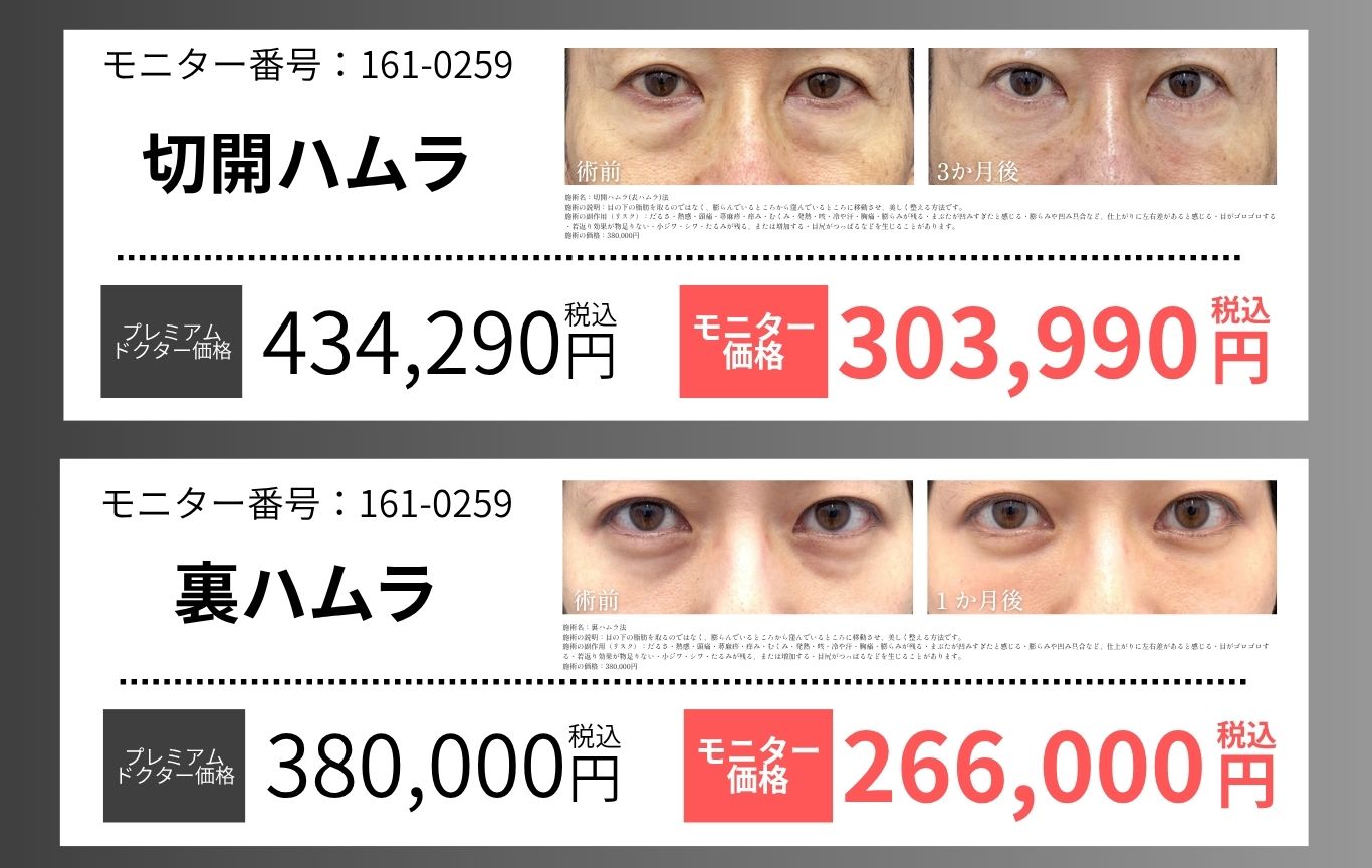 目の下のクマ・たるみ