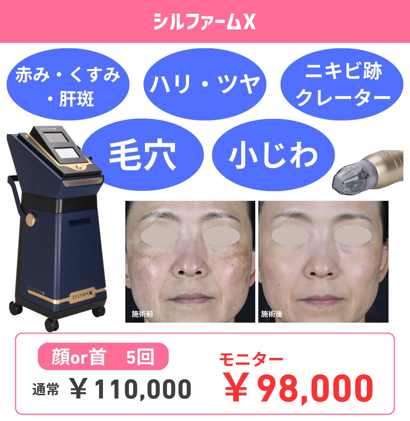 複合的な肌悩みへの最終兵器！