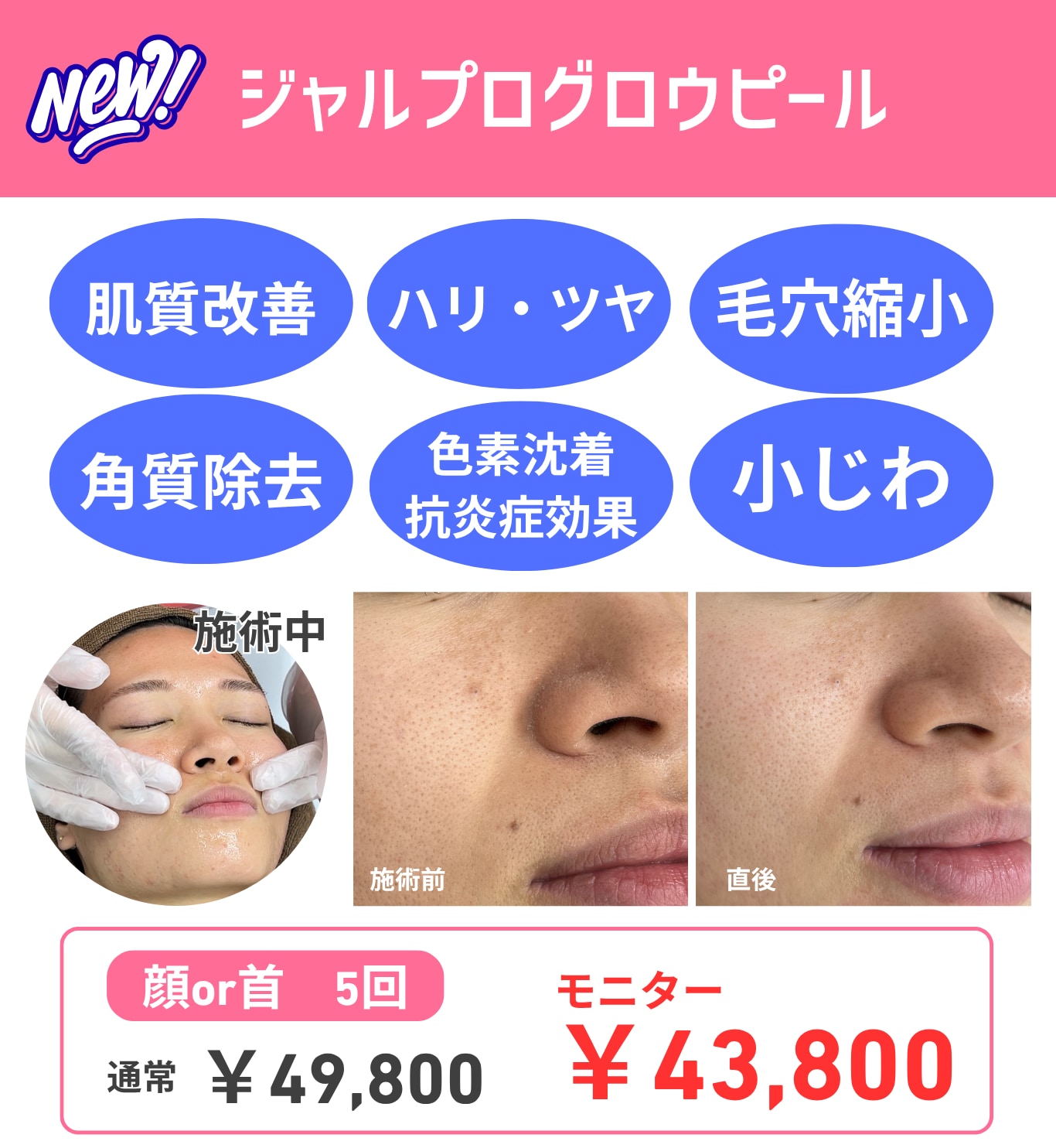 革命！ピーリングで肌質改善⁉