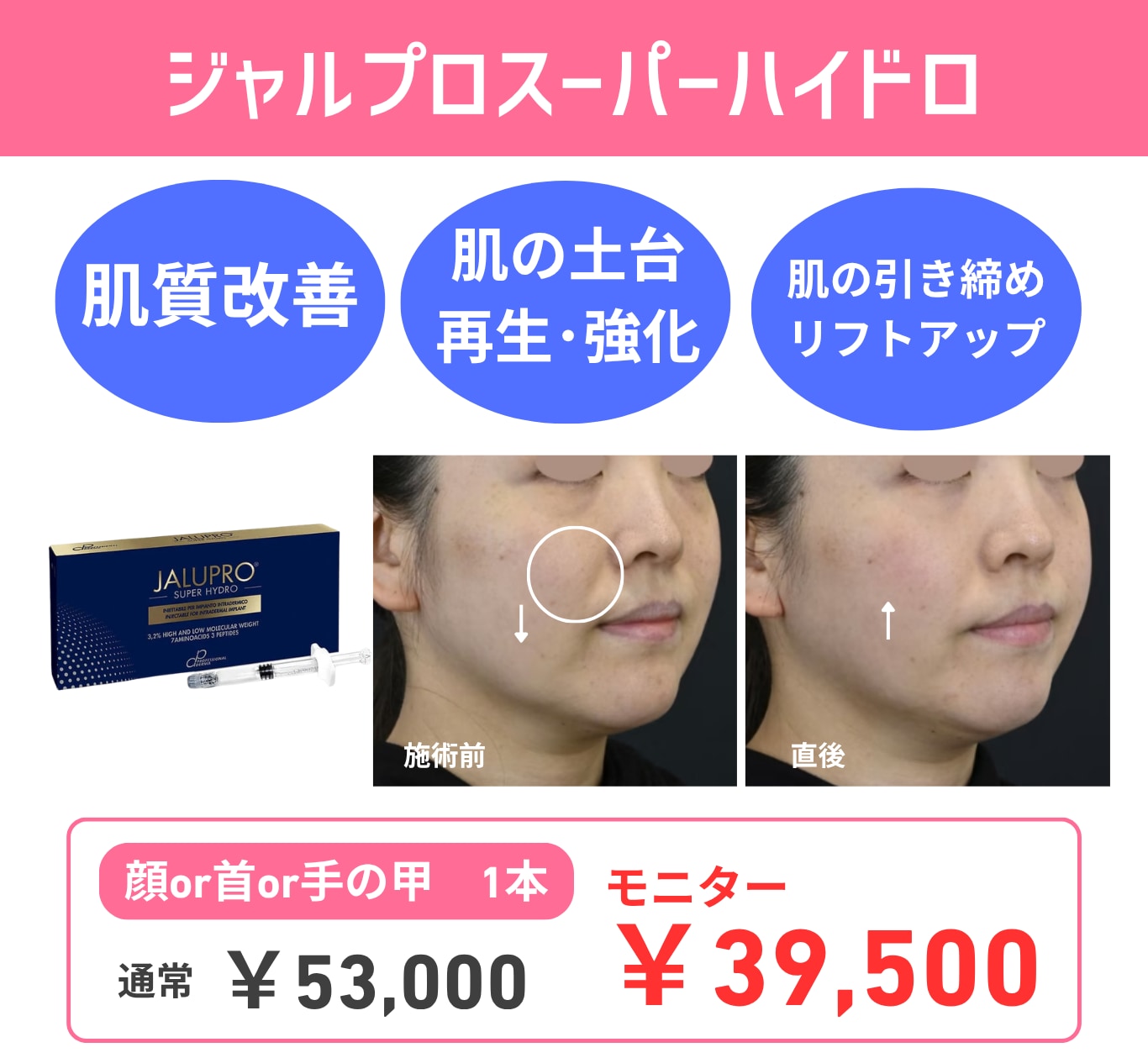 リフトアップ！次世代の肌育注射！