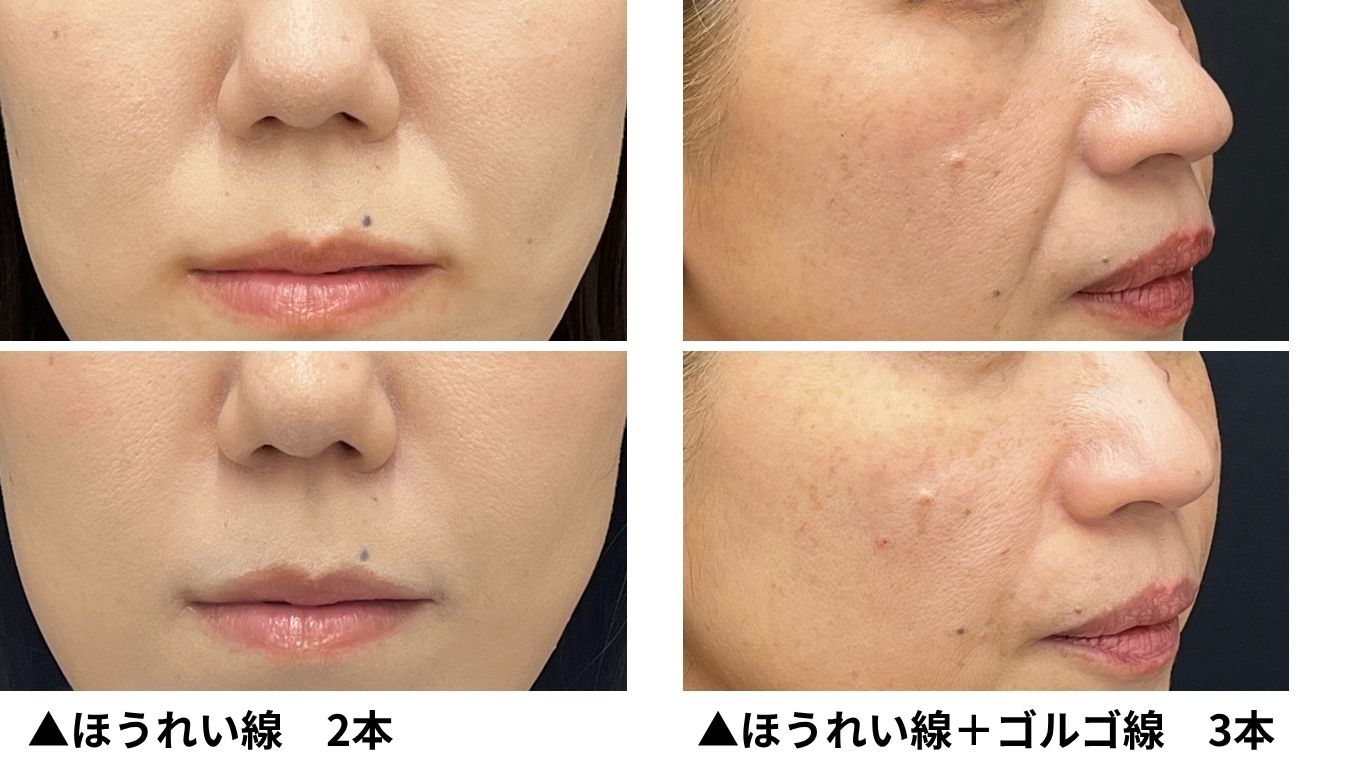 手軽に垢ぬけ・若返り♪