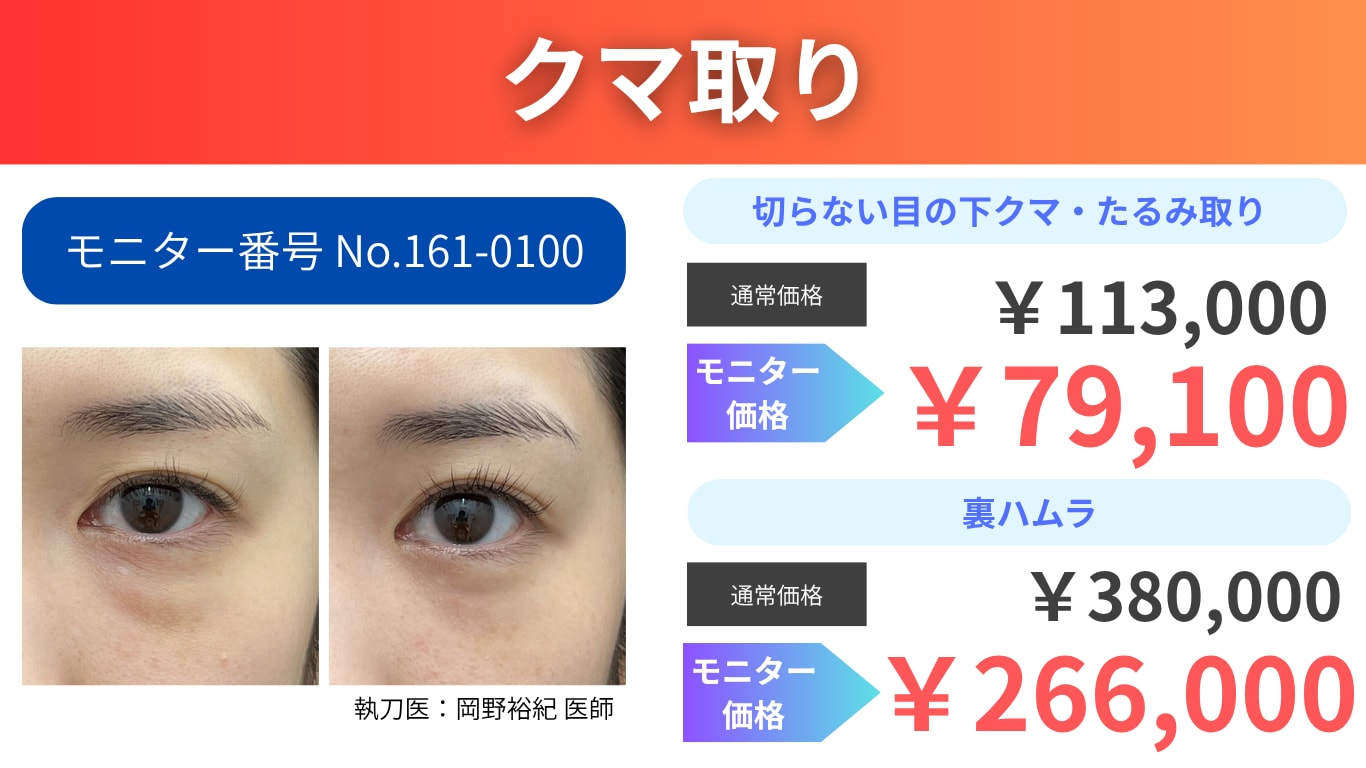 【期間限定】クマ取り２０％OFF！