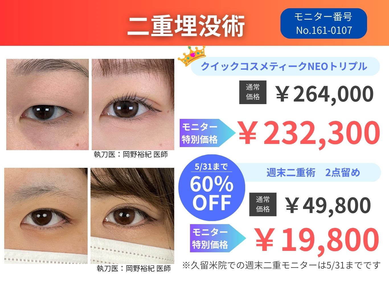 【期間限定】二重埋没術MAX60%OFF！