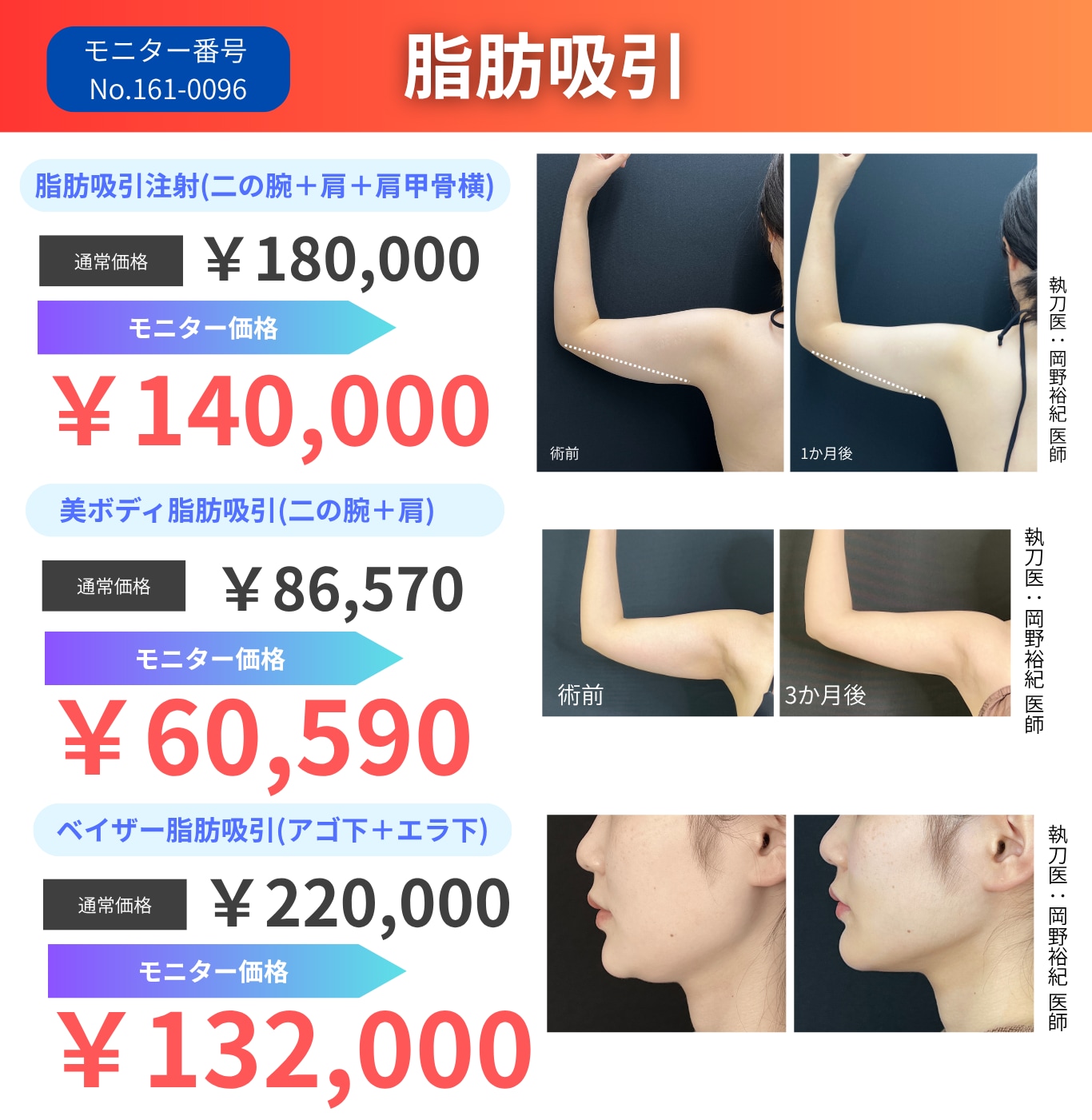 【期間限定】脂肪吸引10%OFF！