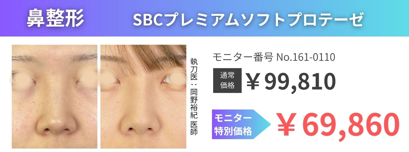 鼻整形モニター