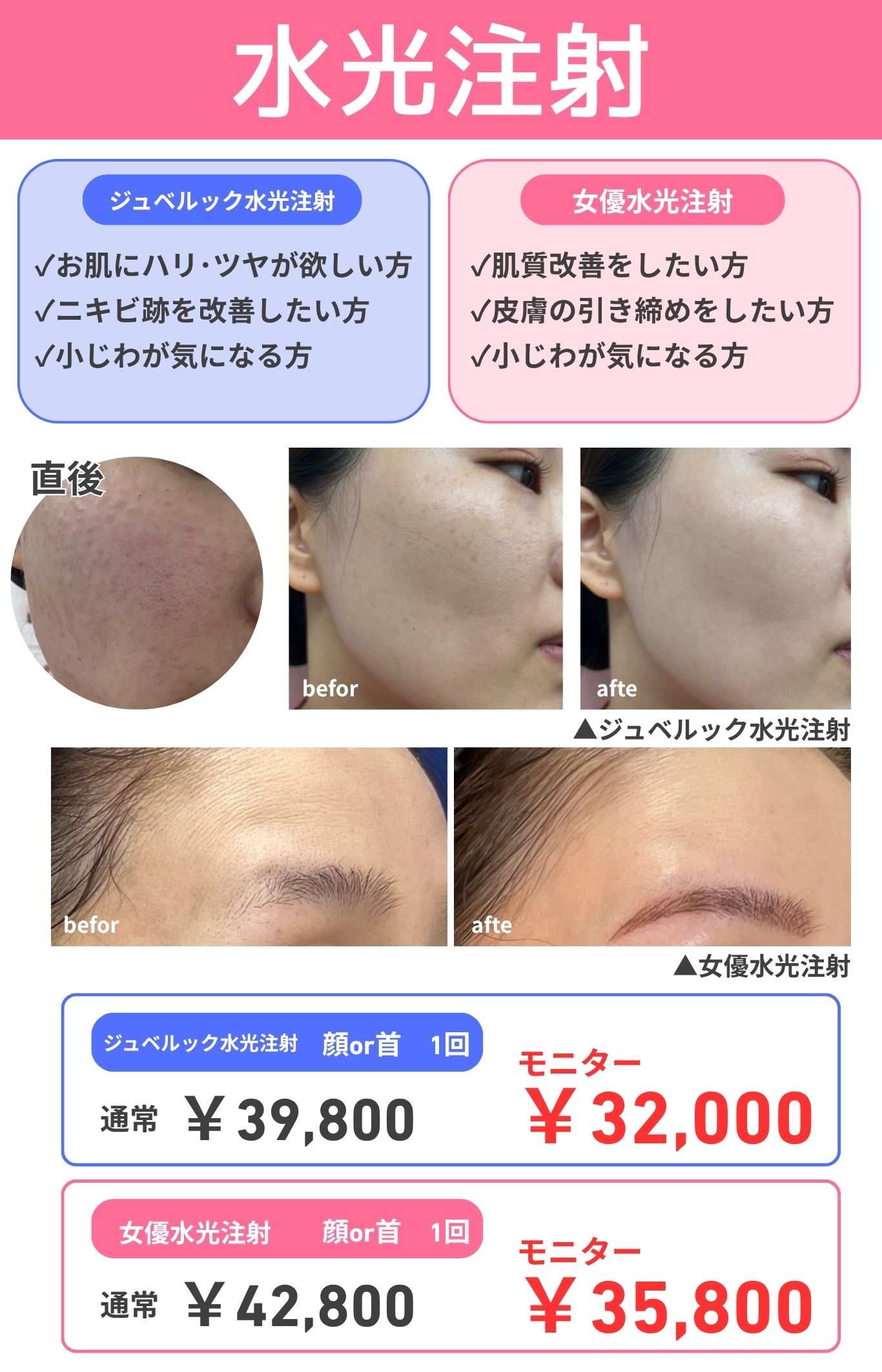 毛穴レス・すっぴん女優肌✨