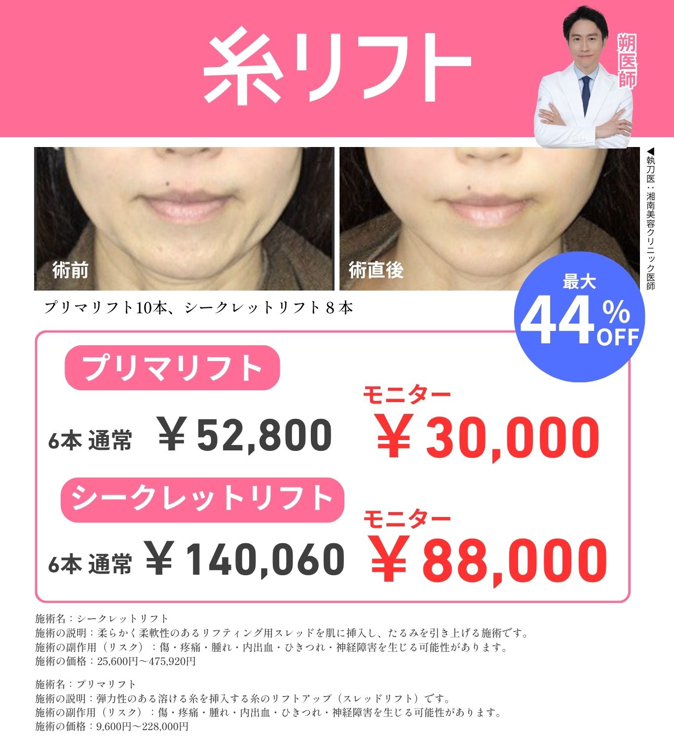 フェイスラインも顎下もスッキリ小顔に