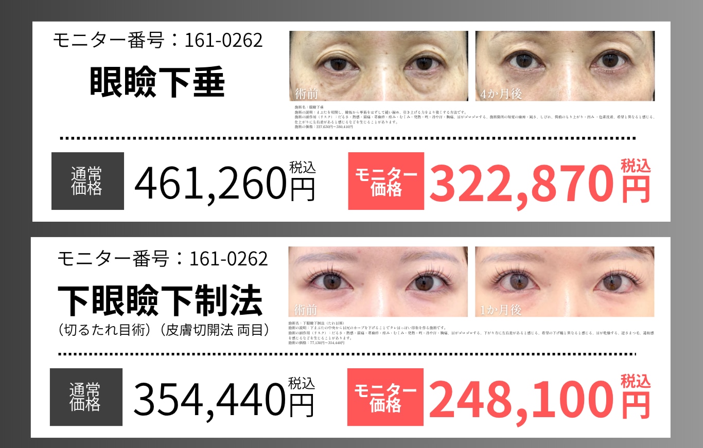 目の開き改善・印象を変えたい