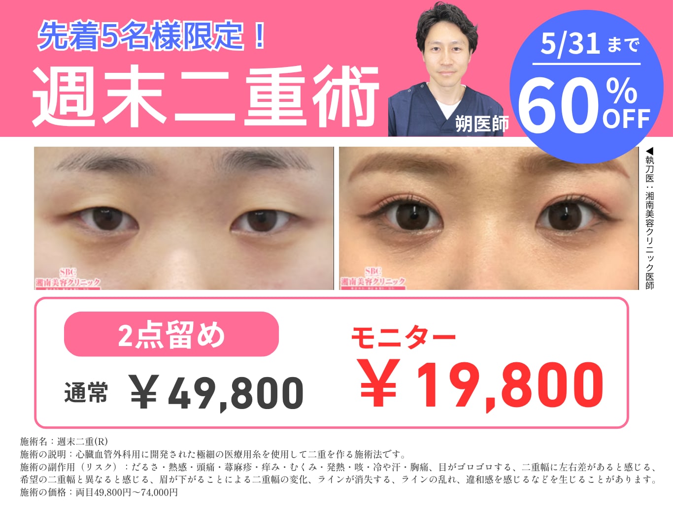 5/31まで！60%OFF！