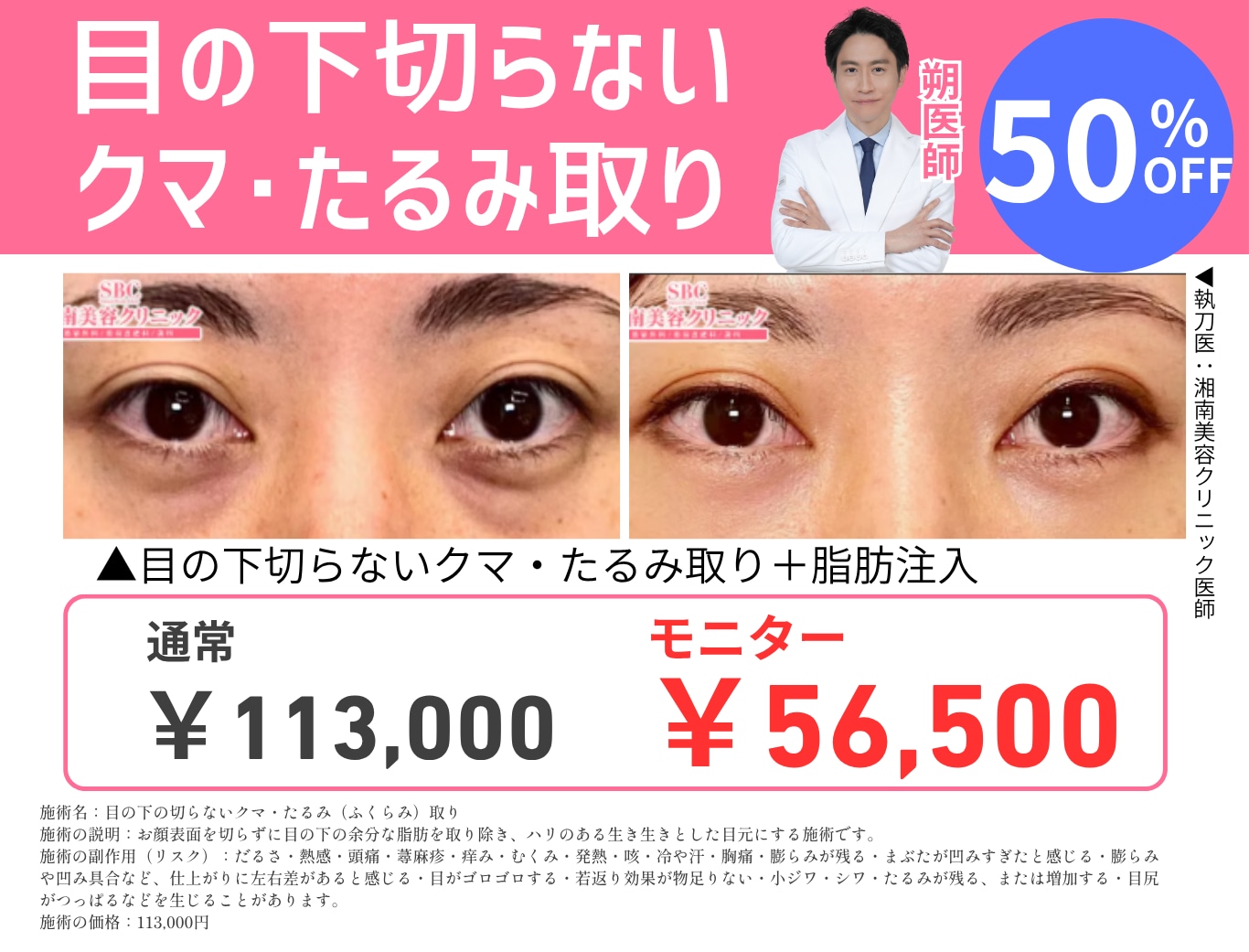 クマ取りで老け顔・疲れ顔解消！✨