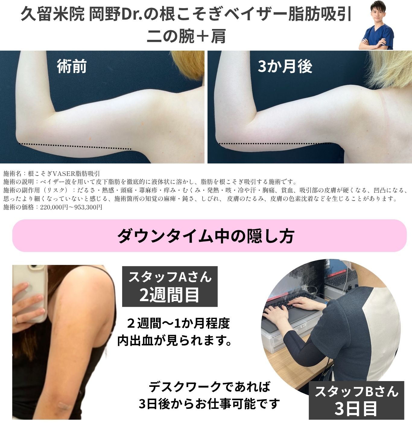 ボディ編