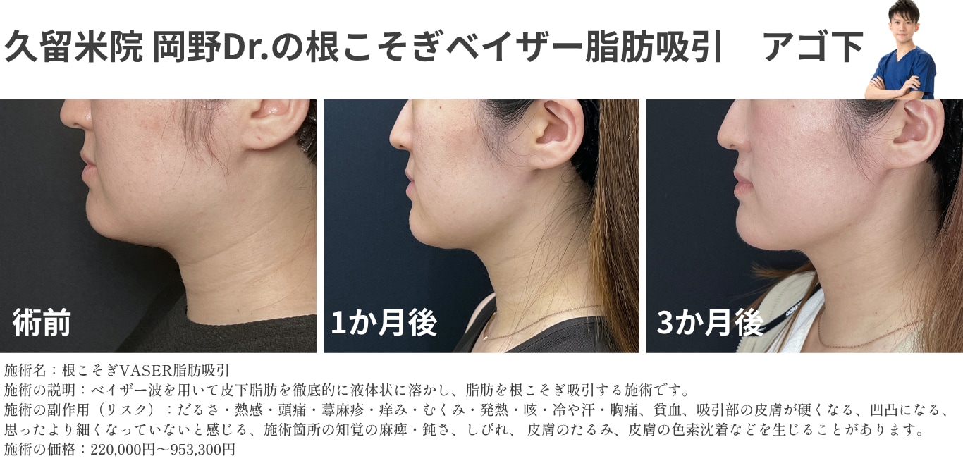 お顔編