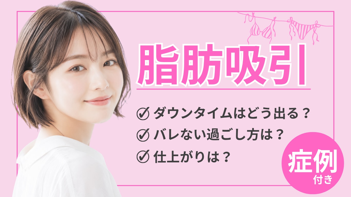 ベイザー脂肪吸引のダウンタイムを徹底解説！痛み・腫れの経過や費用を抑えるコツを紹介【湘南美容クリニック久留米院】