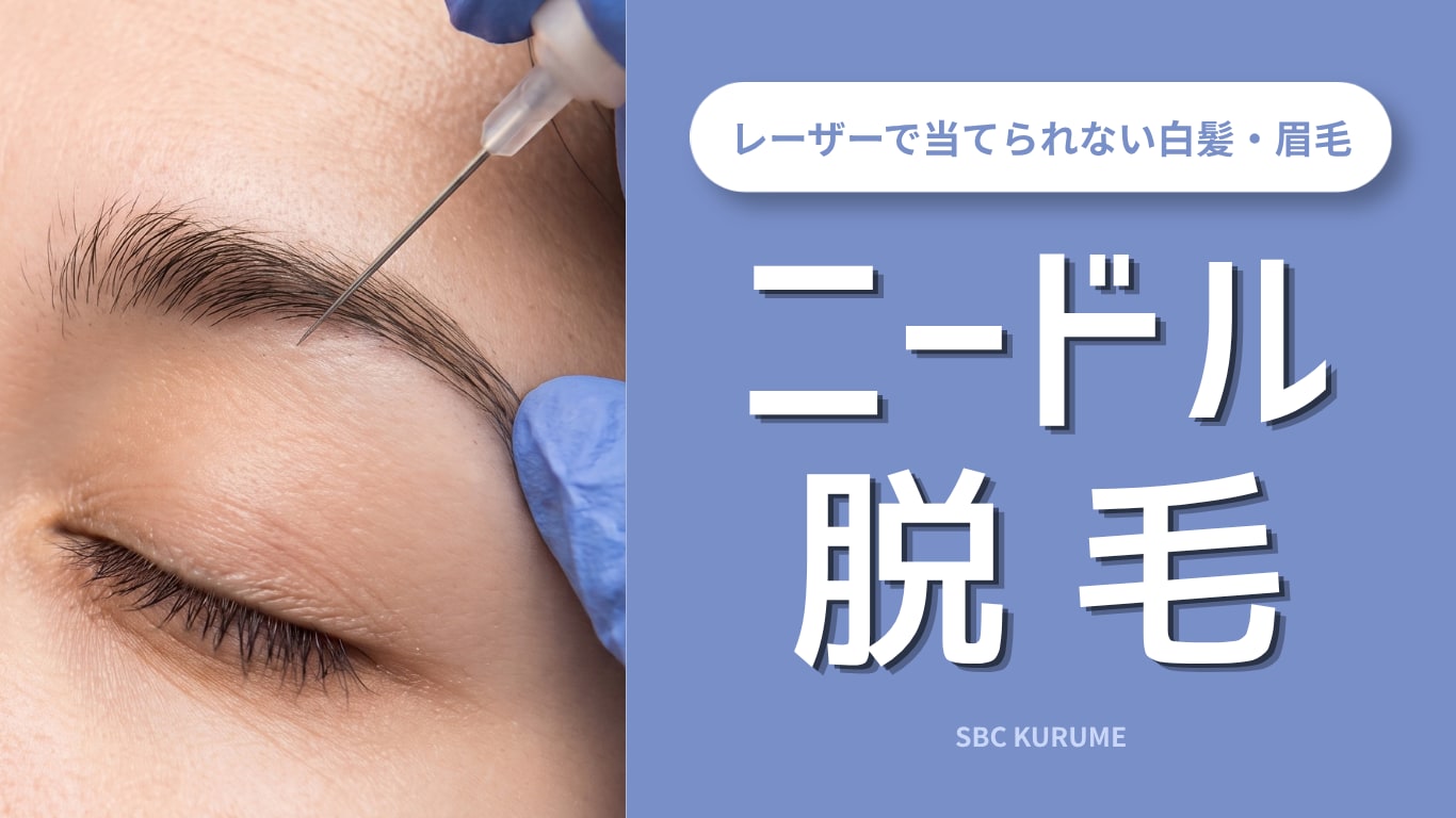 【久留米】白髪や眉毛も永久脱毛！ニードル脱毛（医療針脱毛）徹底解説｜湘南美容クリニック久留米院