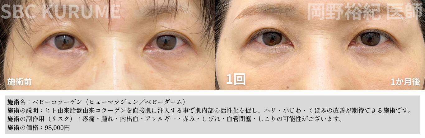 久留米院での変化を実感してください！