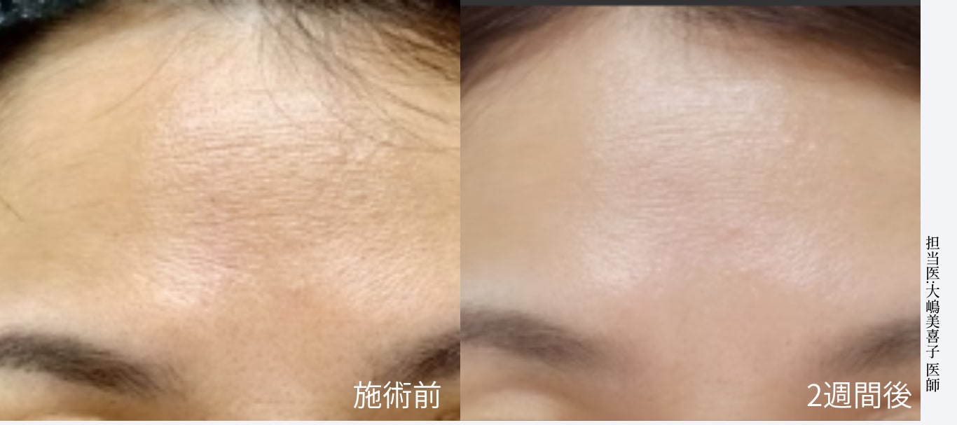 自然な若返りとハリツヤ感を実感