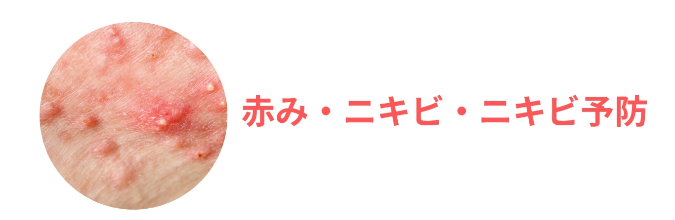 【光治療】アクネライト（ステラM22）