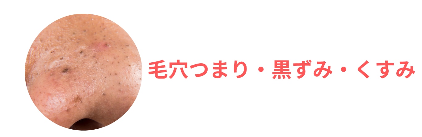 【角質ケア】サリチル酸マクロゴールピーリング