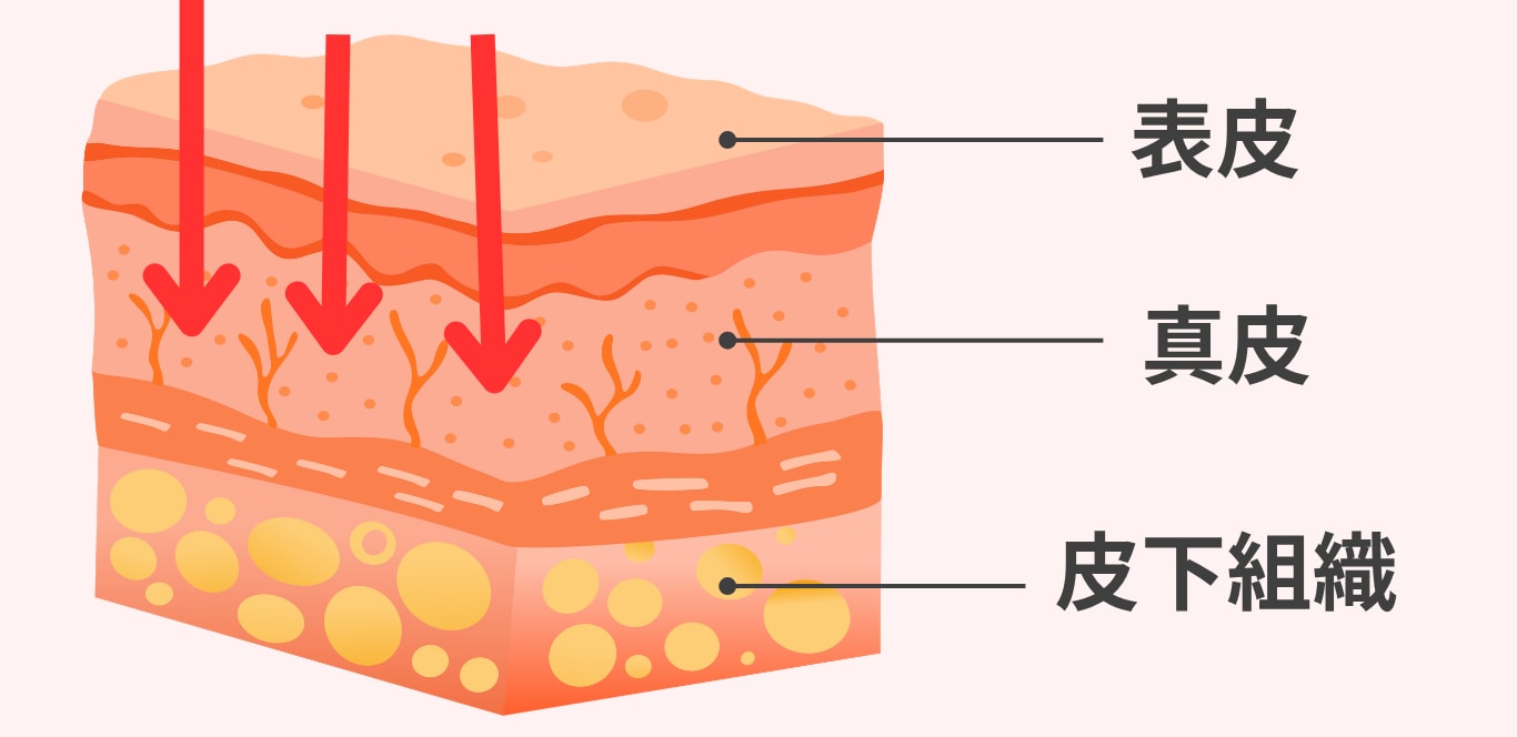真皮層へダイレクトにアプローチする高い肌質改善効果