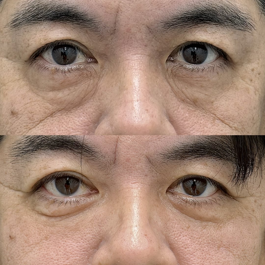 症例3 正面