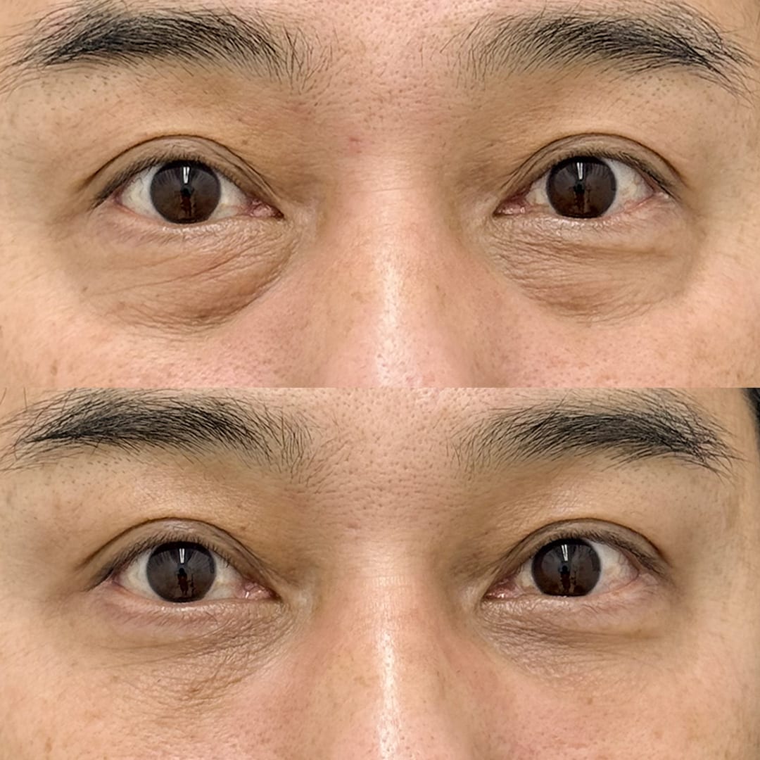 症例2 正面