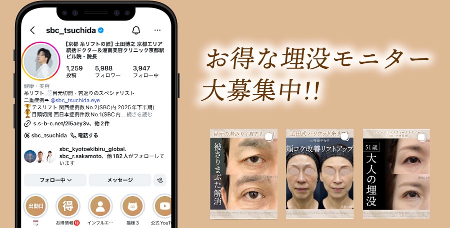 モニター制度の活用 | 症例モデルに応募