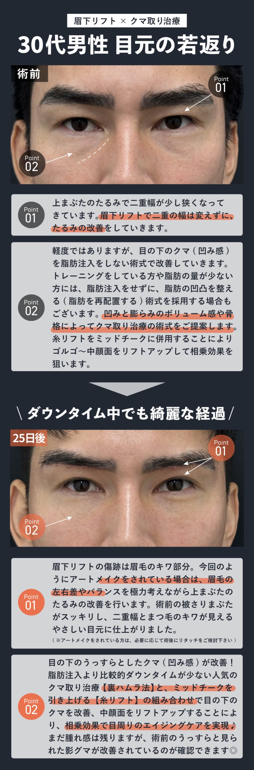 上下のまぶたを同時に若返り！