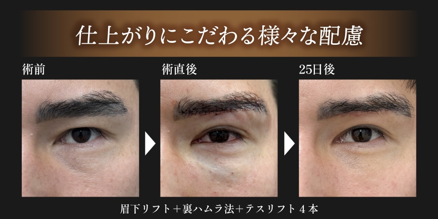 仕上がりにこだわる様々な配慮