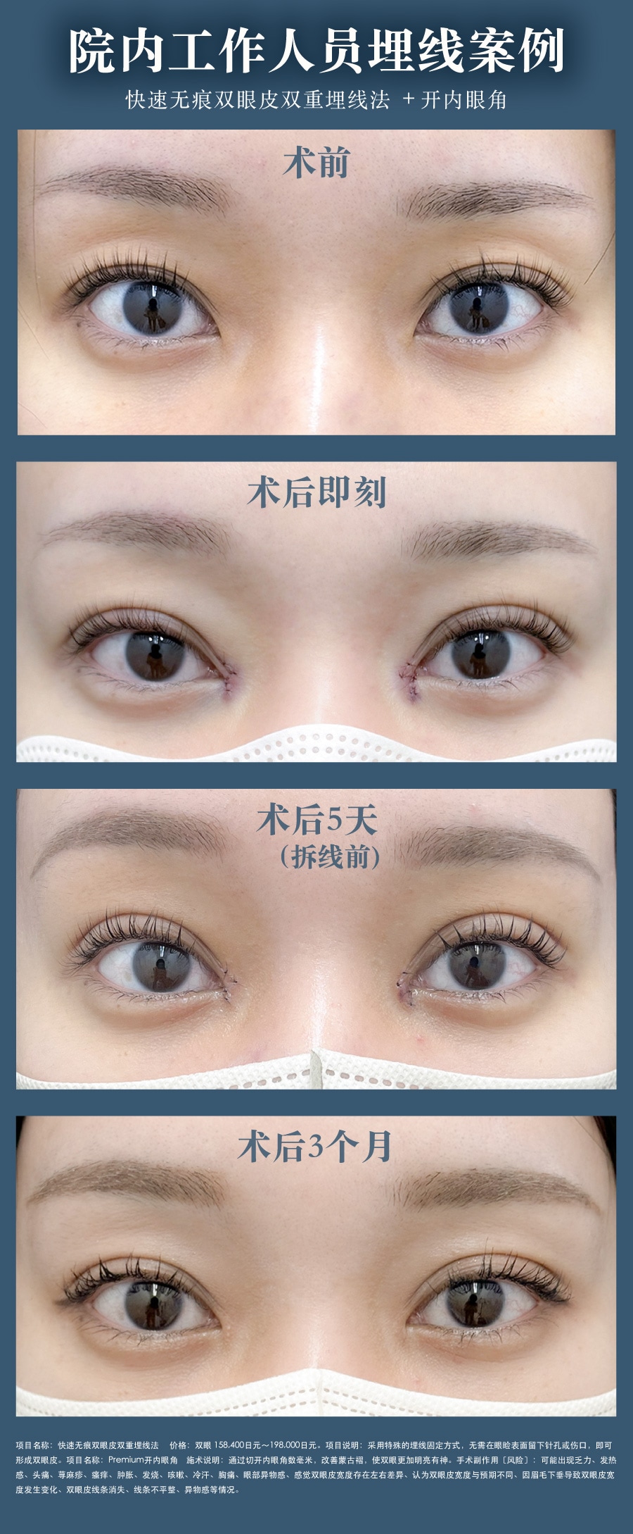 连院内工作人员也认可的实力派医生！顾客指名率超高的专业技术力<br />
