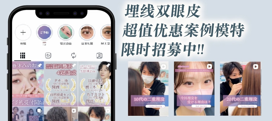 【优惠案例模特招募】由土田院长亲自施作！兼具持久度与设计感的双眼皮埋线术