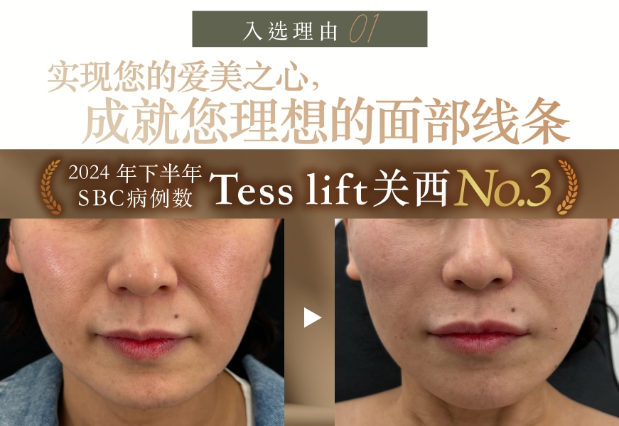 实现您的爱美之心,成就您理想的面部线条<br />