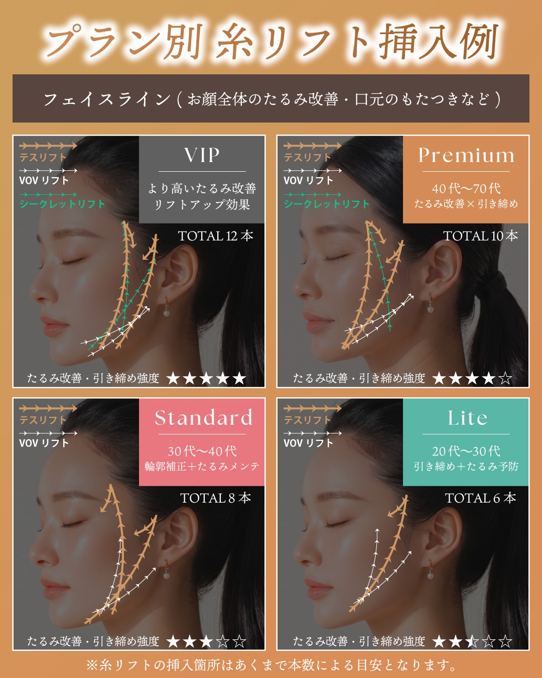 選べる4つの糸リフトプラン
