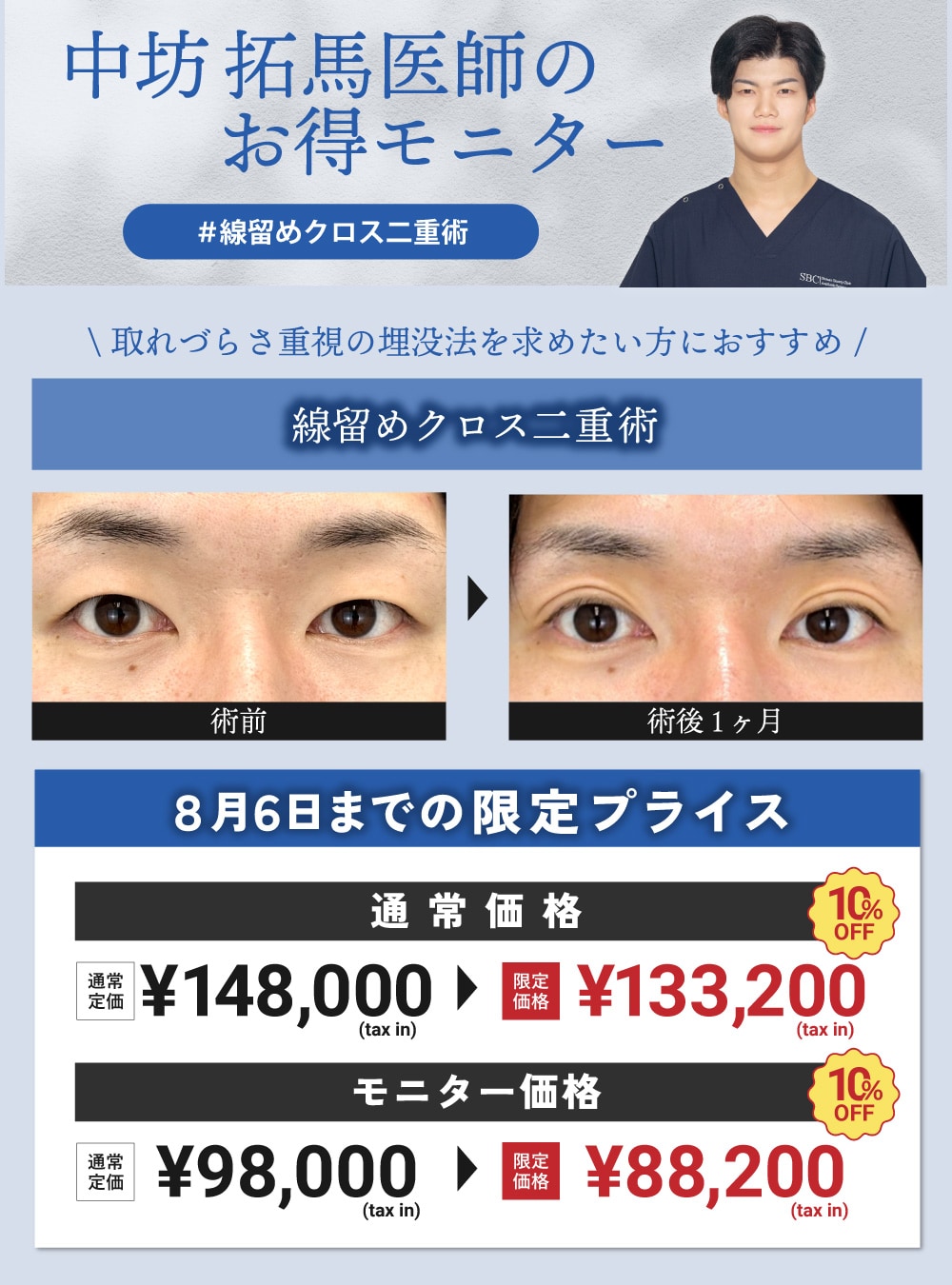 【10%OFF】中坊医師による二重術!