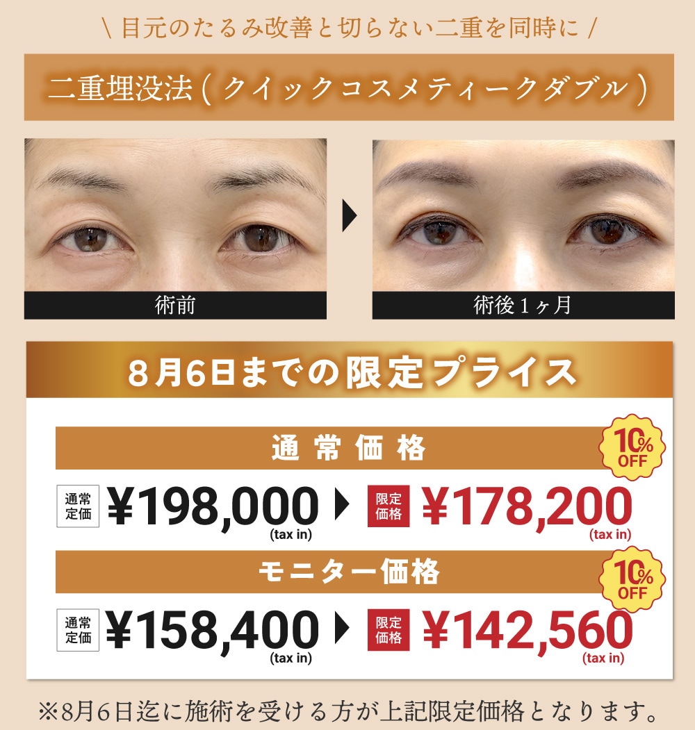 限定医師の【人気埋没法】10%OFF