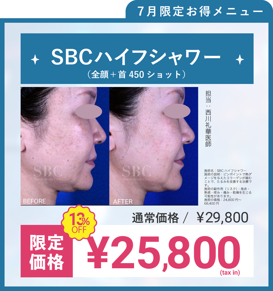 SBCハイフシャワー