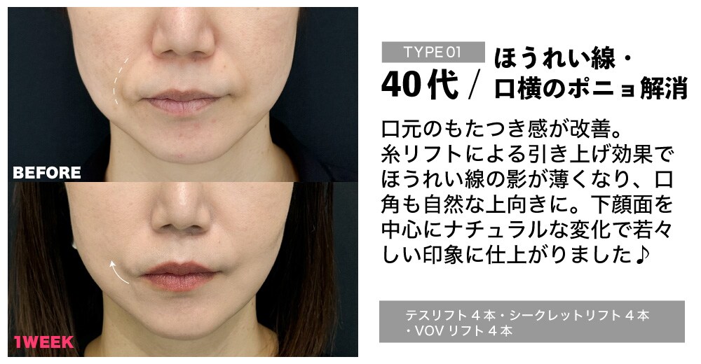 0808APP配信_年代別糸症例1