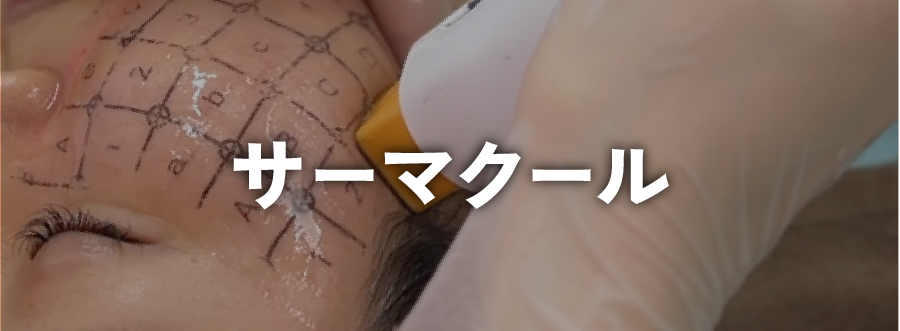 引き締め治療
