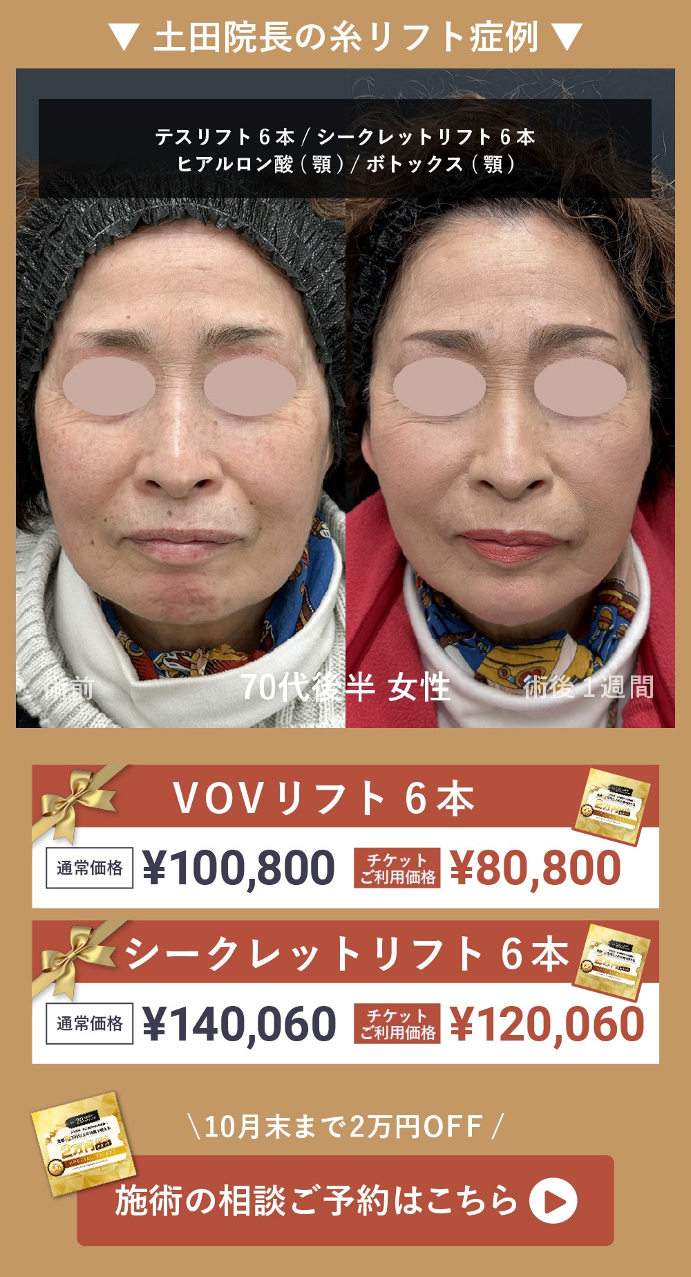 0928_アプリ配信_外科CP_4