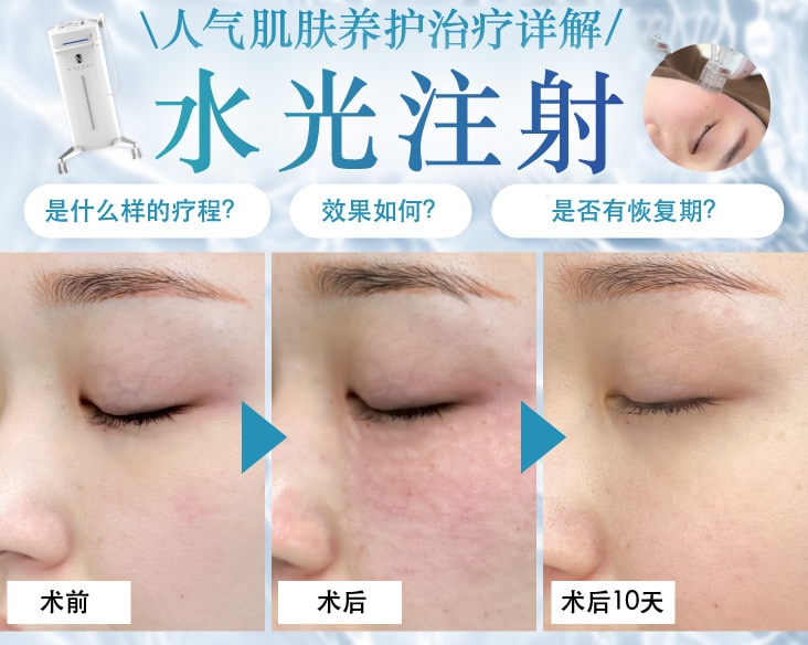 打造水光肌・京都育肌注射首选【湘南美容诊所 京都站大楼院】