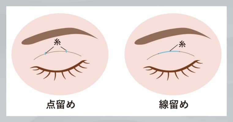 特殊な縫合で「取れにくい」を追求<br />
