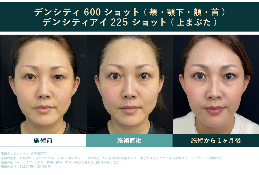 30代後半女性のスタッフ