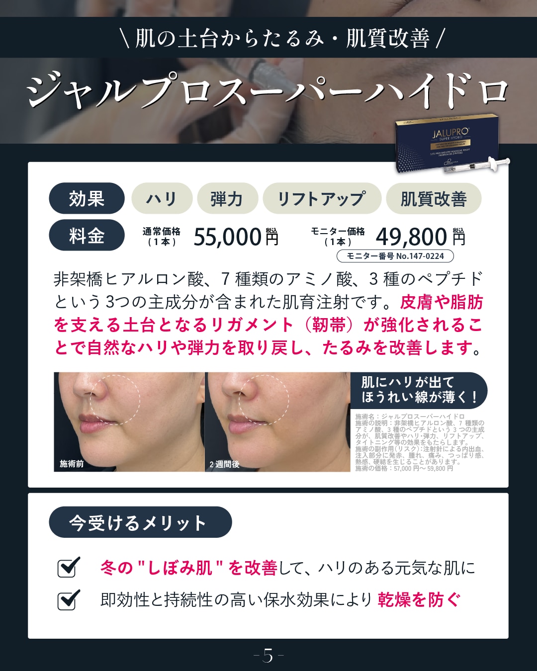 リフトアップしたい方はこれ！