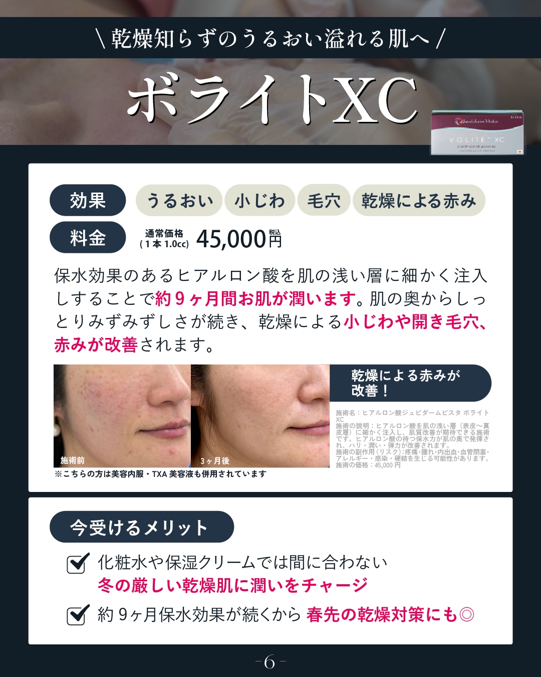 乾燥を改善したい方はこれ！