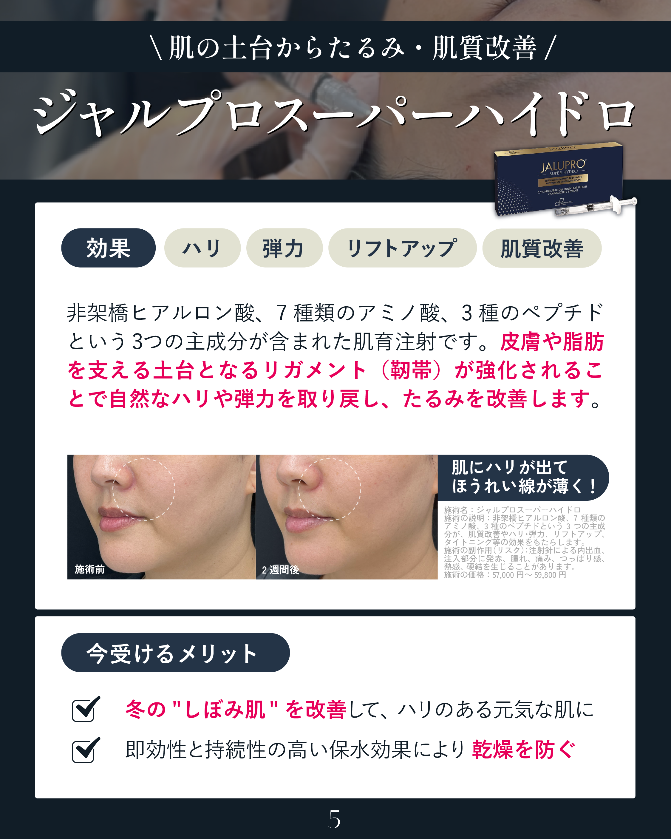 リフトアップしたい方はこれ！